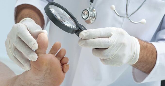 Examen diagnostique des ongles des pieds