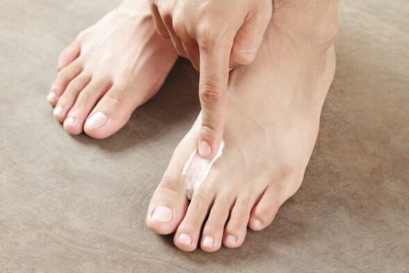 application d'onguents du champignon de la peau sur les jambes